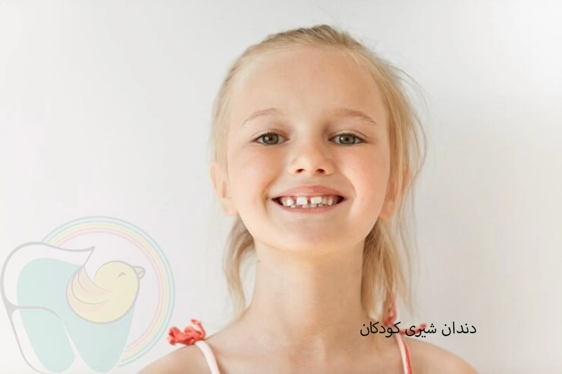 دندان شیری کودکان چند تاست و کی می افتند؟
