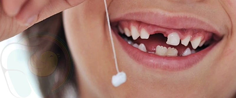 افتادن دندان کودکان