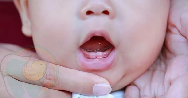 سن, علائم و نشانه های دندان درآوردن نوزاد +  عکس
