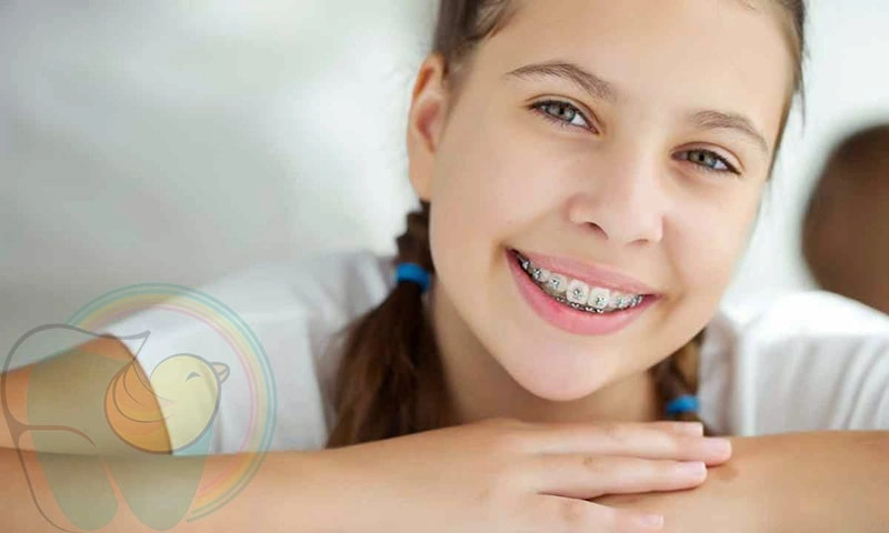 ارتودنسی پیشگیری در کودکان چیست و در چه سنی مناسب است؟