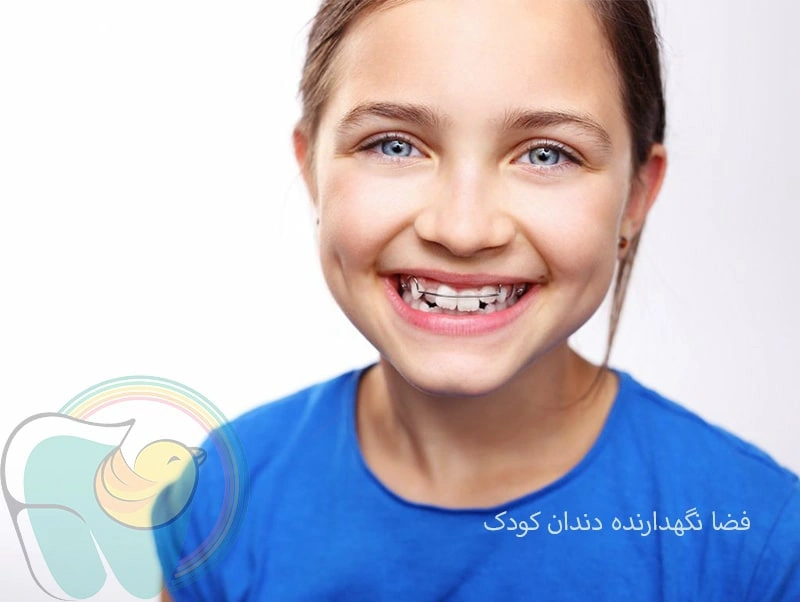 فضا نگهدارنده دندان کودک چیست؟